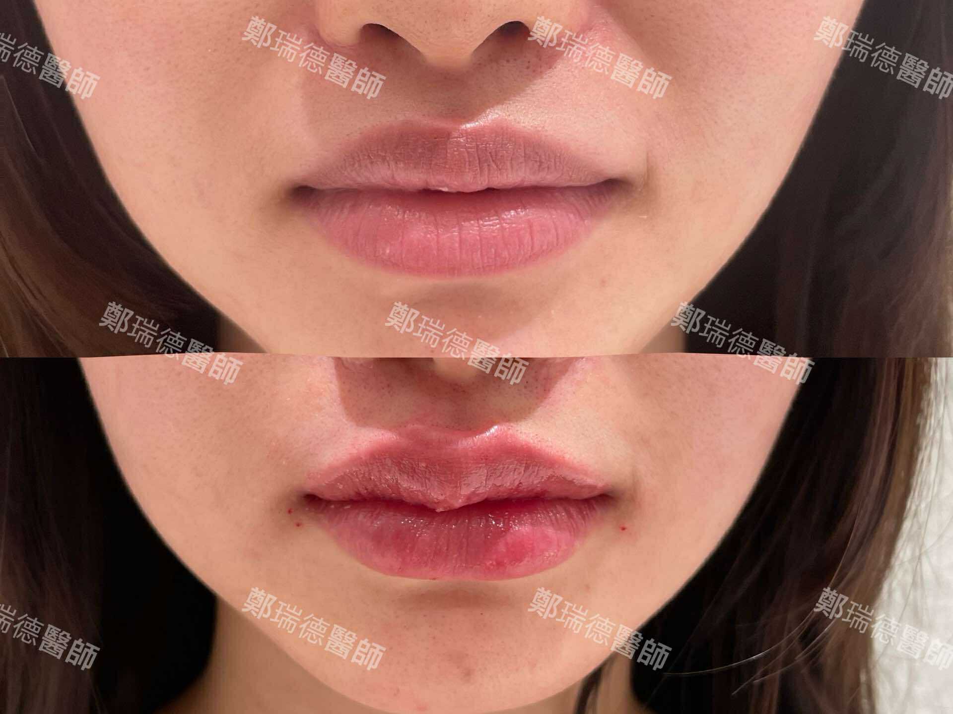 美學案例前後對比 — 圖片 6