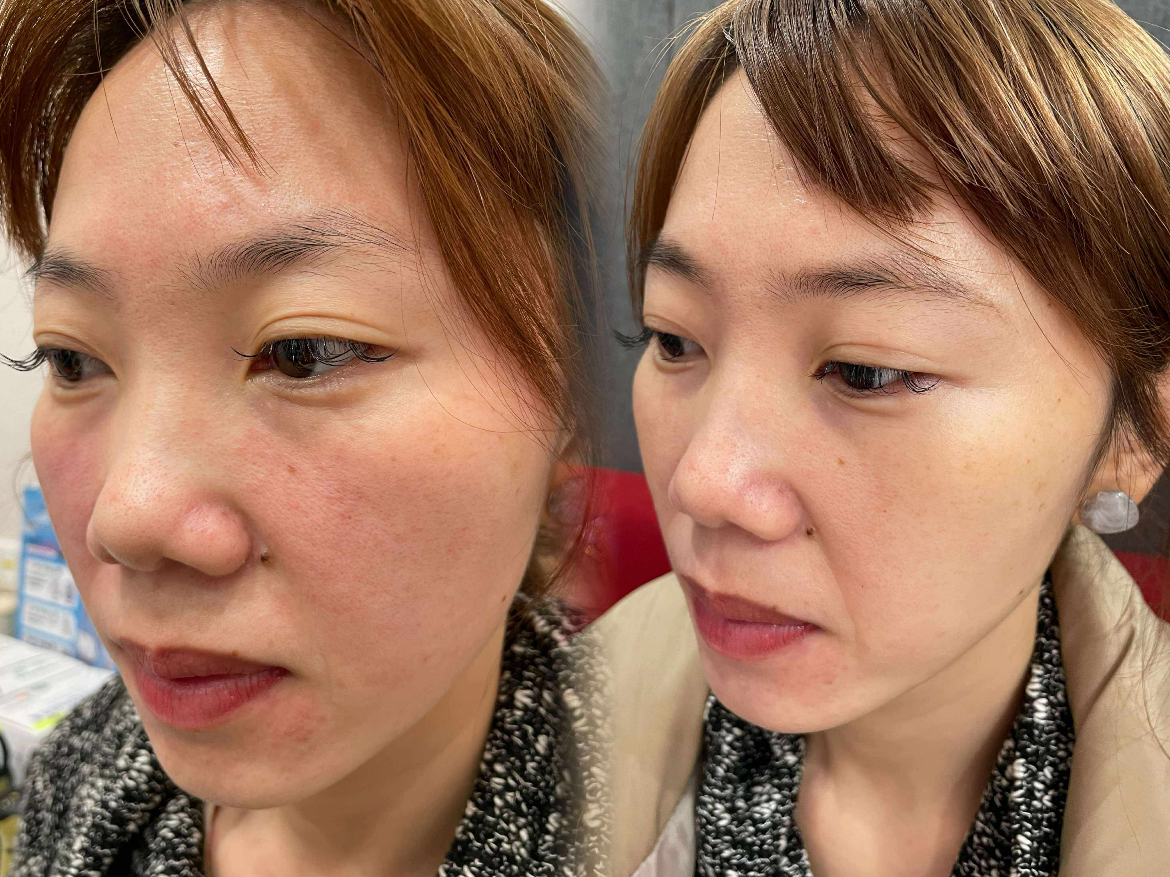 美學案例前後對比 — 圖片 9